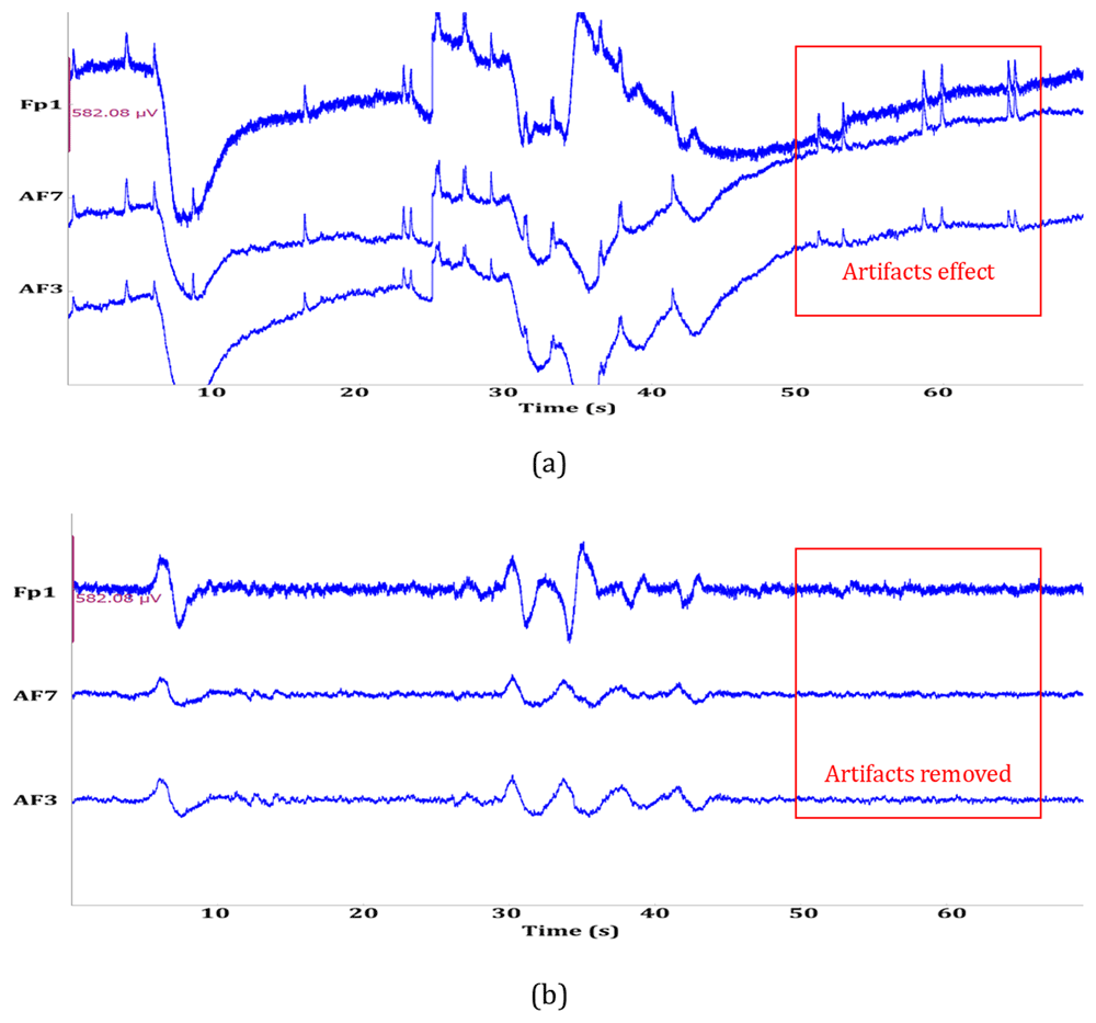 EEG-Based Inner Speech Decoding Using | Open Research Africa