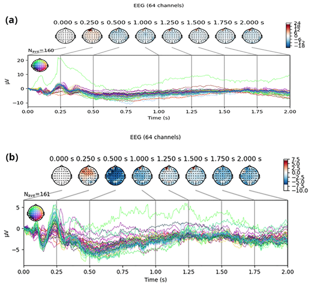 EEG-Based Inner Speech Decoding Using | Open Research Africa